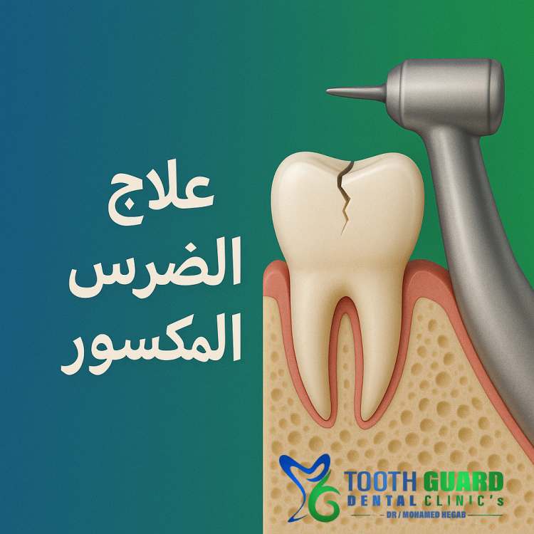 احدث علاج الضرس المكسور